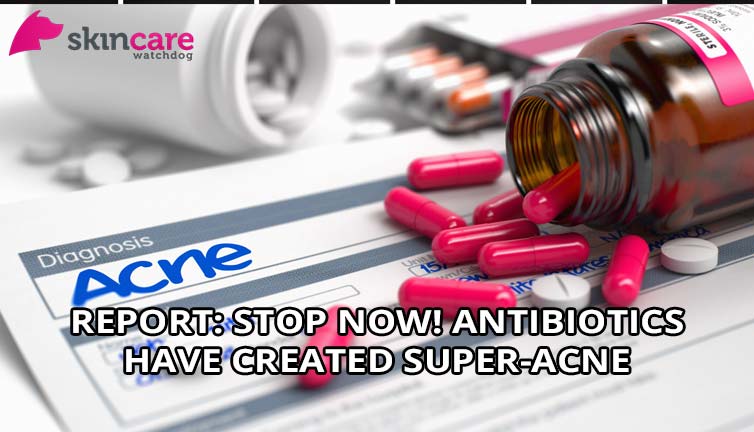 Report-Stop-Now!-Antibiotics-Have-Created-Super-Acne